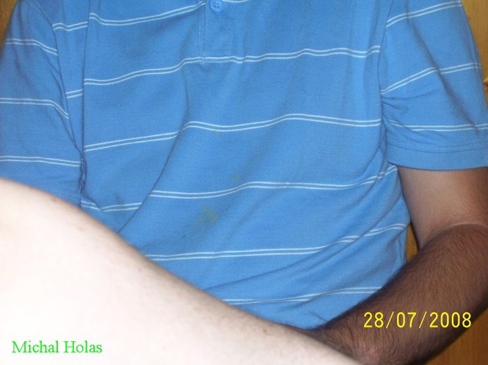 36 Jirkovo tri ko utrp lo  jmu p i sr  ce se serv rkou